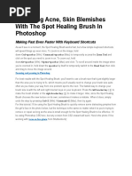 Removing Acne, Skin Blemishes With The Spot Healing Brush in Photoshop