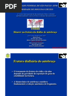 Ilizarov na fratura da diáfise de antebraço. JoséCarlos Bongiovanni, M.D., Hilário Boatto, Osvaldo clinco Júnior, Rubens Augusto Salvadori Martinhão, Marcus Aurelio Preti, Marcelo Fumio Utsunomiya, Diego Bongiovanni, Robson Toshimitsu Kiyohara. 