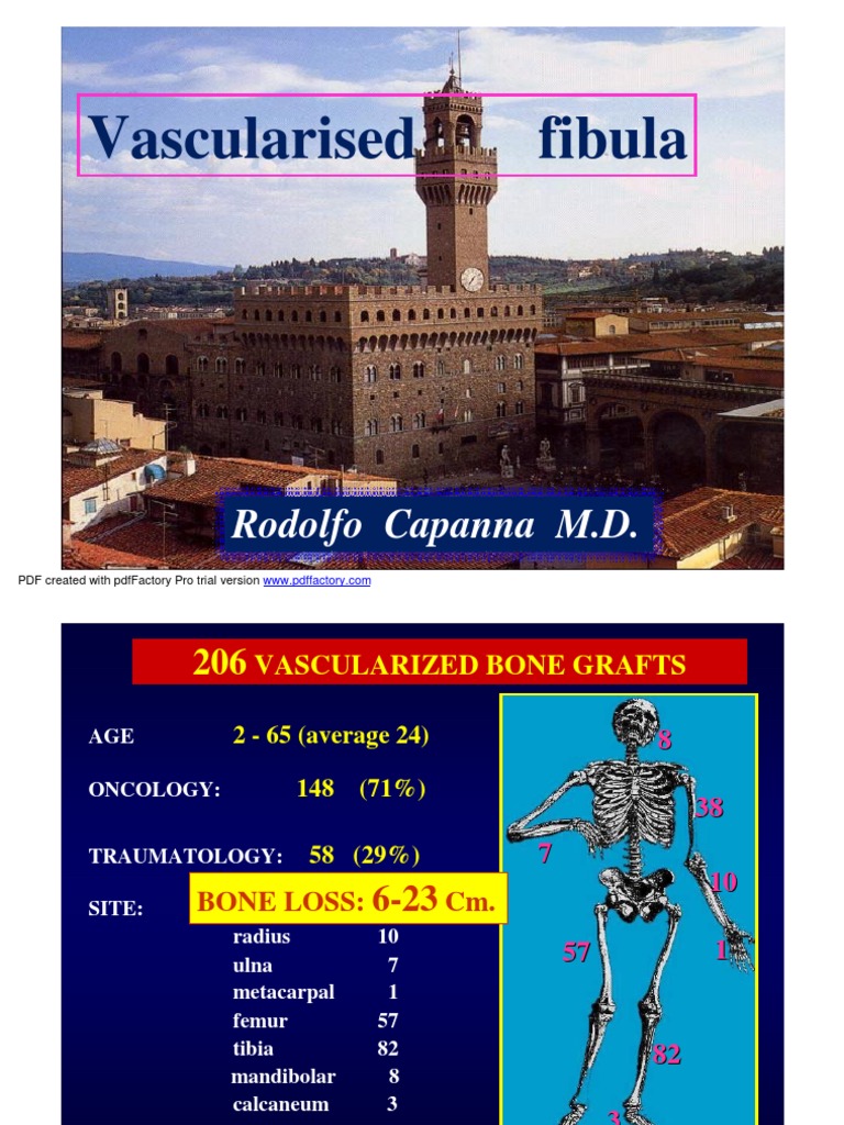 Vascularised Fibula. Rodolfo Capanna | PDF | Human Leg | Bone