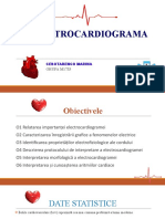 Electrocardiogram A