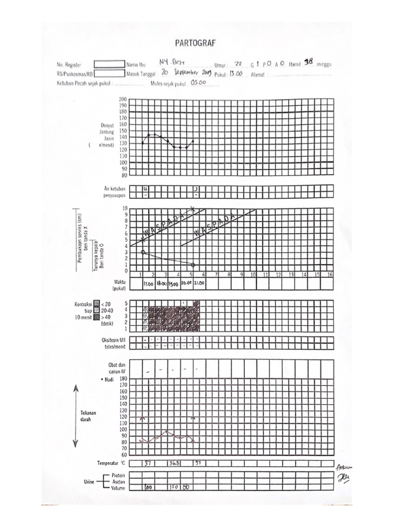 PARTOGRAF | PDF