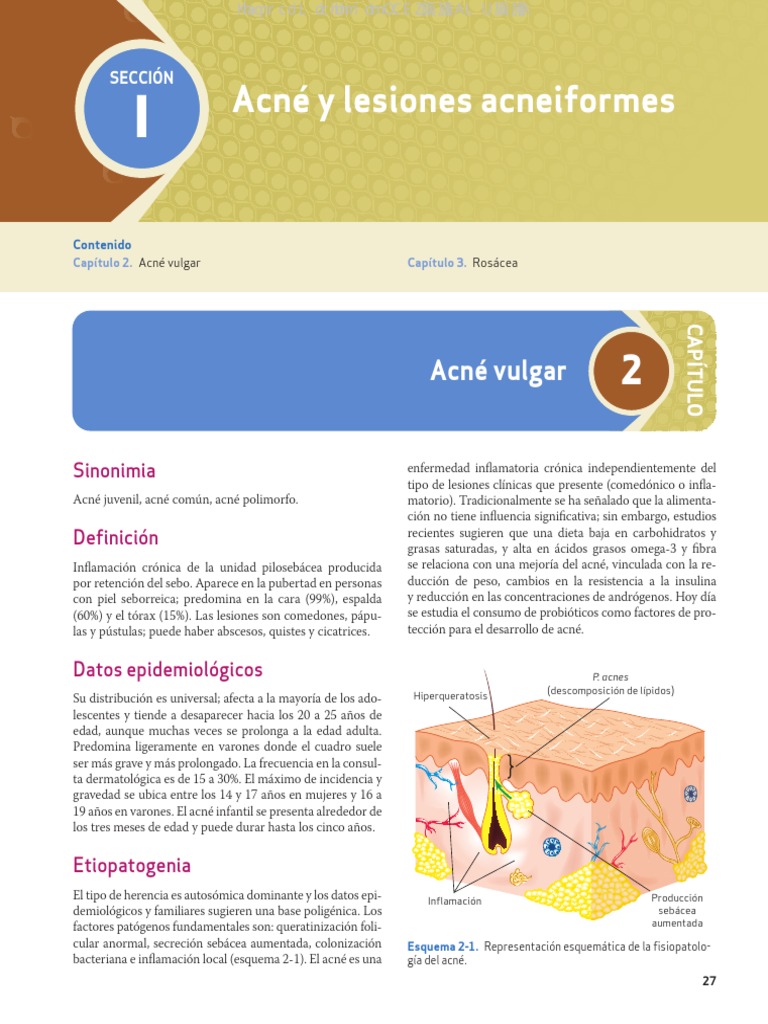 clasificaci-n-y-etiopatogenia-del-acn-pdf-especialidades-medicas