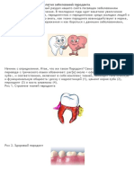-Stroenie parodonta i e#tiologija zabolevanij# parodonta