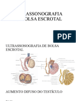 Resumo de Ultrassonografia de Bolsa Escrotal