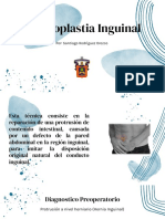 Hernioplastia Inguinal