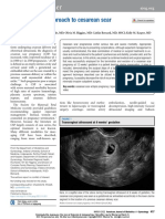 2022 AJOG A Laparoscopic Approach To Cesarean Scar Ectopic Pregnancy