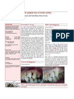 A 60-Year-Old Male With Gradual Loss of Tooth Surface: Presentation of Case Differential Diagnosis
