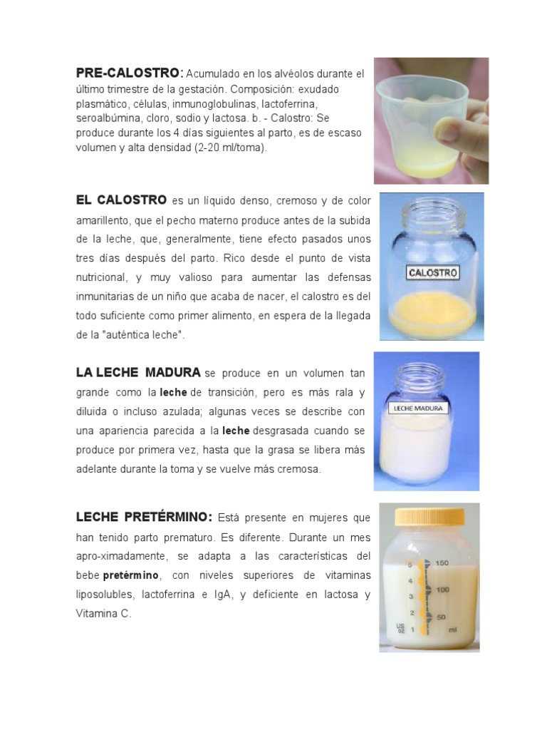 Color y tipos de calostro materno | PDF