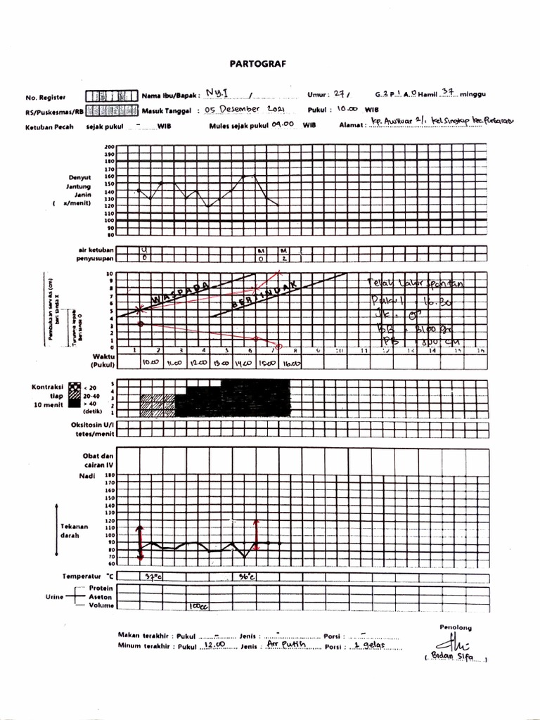 Partograf | PDF