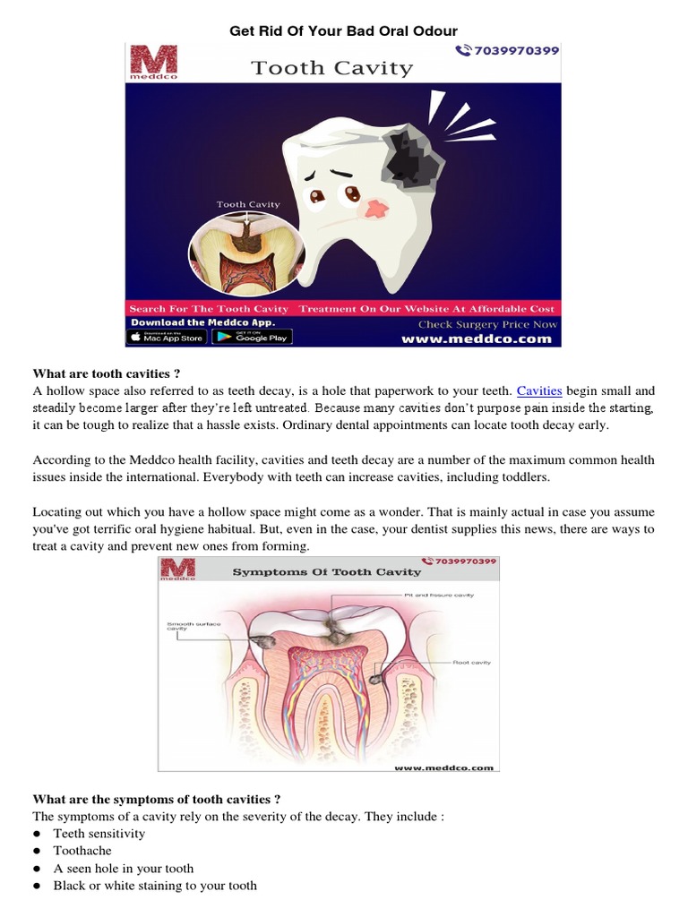 Tooth Cavity | PDF | Oral Hygiene | Dentist