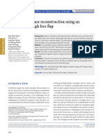 Anterior Skull Base Reconstruction Using An Anterolateral Thigh Free Flap