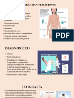 Cáncer de Ovario-Manifestaciones Clinicas - Stefany Vaz