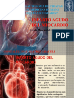 Acute Myocardial Infarction-Ara (2)