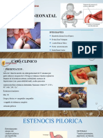 Pilorotomia Neonatal DX