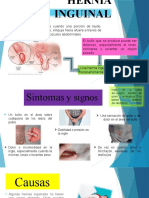 HERNIA INGUINAL y Candidiasis Vaginal