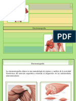 EMG Diagnóstico Enfermedades Neuromusculares