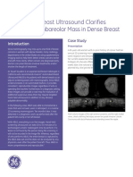 Global DR Souders ABUS Case Study - Final 2017