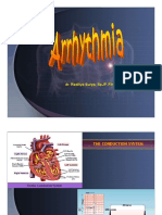 Aritmia - DR Raditya