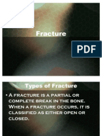 47311036-Fracture