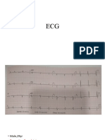 ecg anj