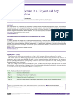 Talar Body Fracture in A 10-Year-Old Boy. Case Presentation: Tamara Rodríguez-López, Alberto Núñez Medina