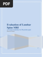 Download Evaluation of Lumbar Spine MRI by Dharam Pandey SN56799562 doc pdf