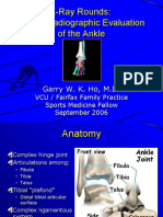 X-Ray Rounds: (Plain) Radiographic Evaluation of The Ankle