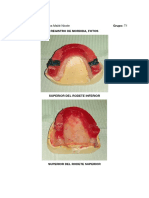 Fotos Registro de Mordida