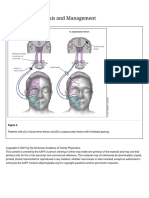 Bell's Palsy - Facial Nerve and Supranuclear Lesion