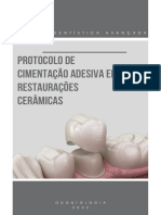 Protocolo de cimentação adesiva em restaurações cerâmicas