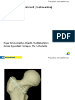 FX Trocantericas 3