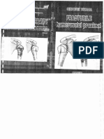 Fracturile humerusului proximal