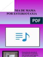 Biopsia de Mama Por Estereotaxia