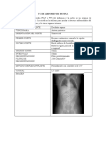 TC de Abdomen de Rutina