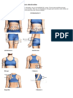 Zonas de Aplicación para Electrodos