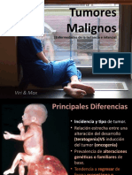 Tumores Malignos