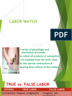Labor Watch