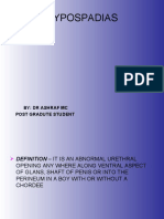 Hypospadias: By: DR Ashraf MC Post Gradute Student