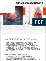 Cardiopatía isquémica: causas, síntomas y factores de riesgo