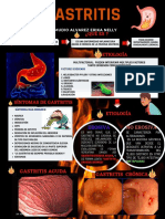 Gastritis: causas, síntomas y tratamiento