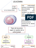 LEUCEMIA