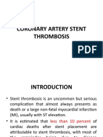 Coronary Artery Stent Thrombosis