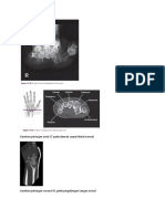 CT scan normal pergelangan tangan