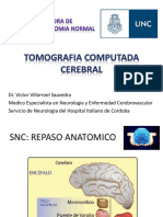 Anatomia TC de Cerebro