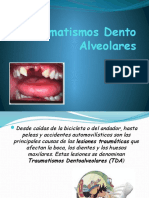 Traumatismo Dento Alveolar