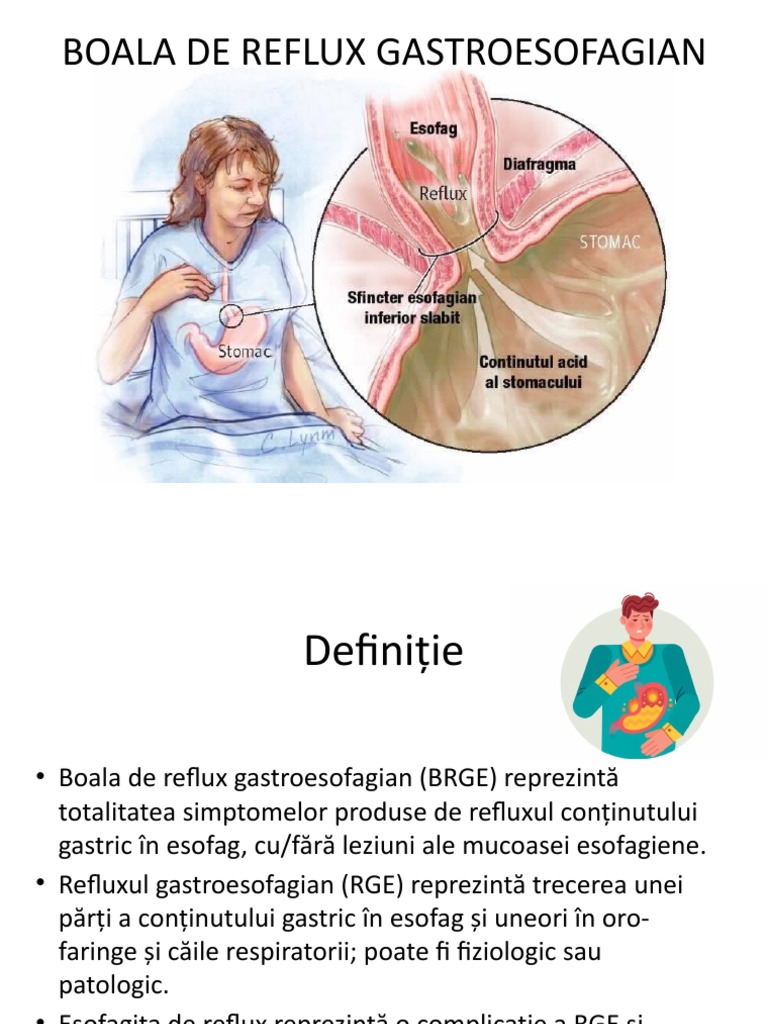 Boala Reflux Gastroesofagian Regim – WCSNHS