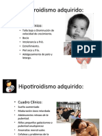 Hipotiroidismo Adquirido ( Cuadro Clinico)