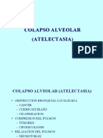 Colapso Relleno Alveolar