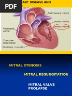 Download MITRAL VALVE by singhal2 SN5706242 doc pdf