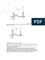 EKG